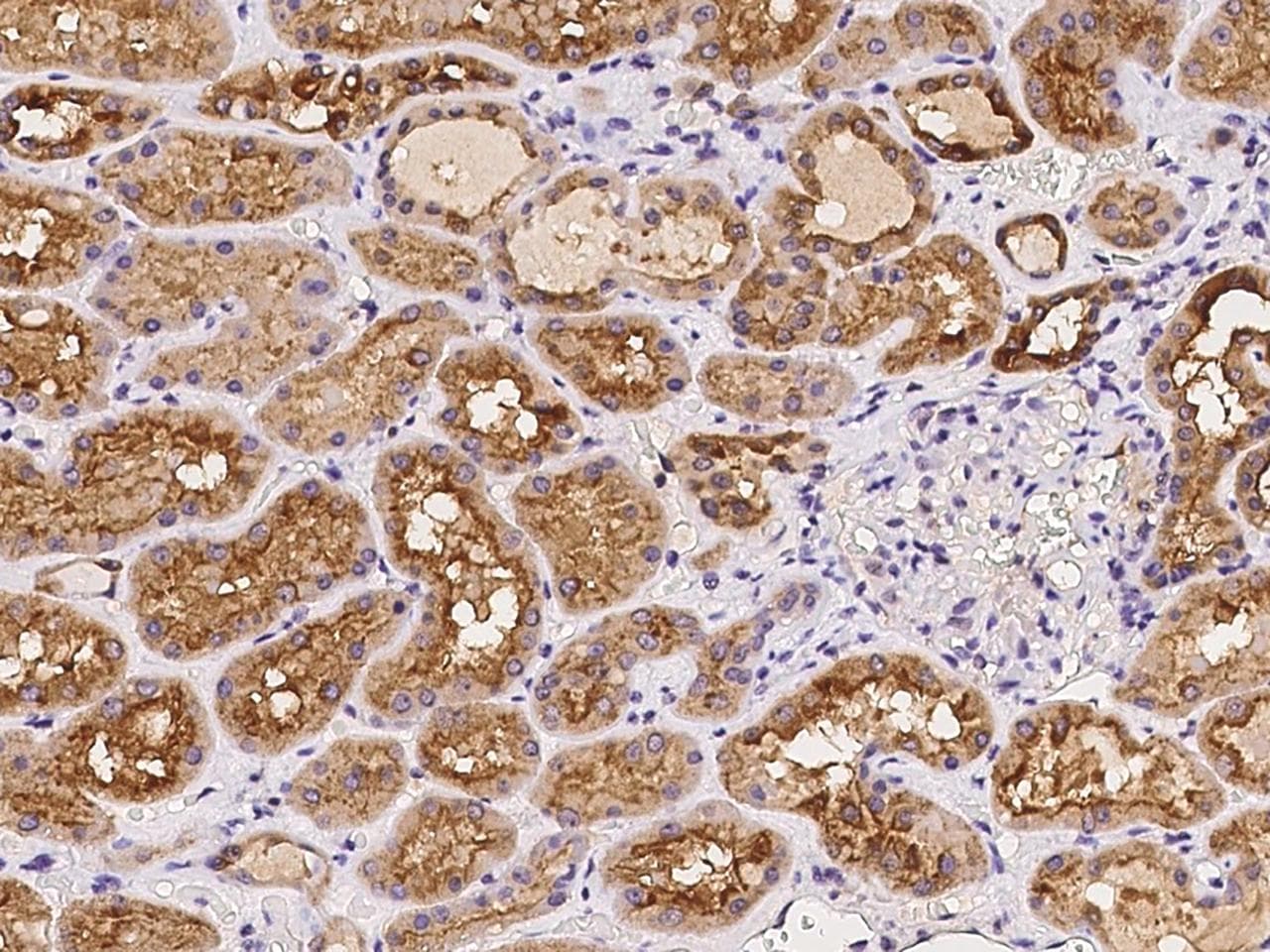 Polyclonal Rabbit anti-Human ATP6V1F Antibody (IHC, IF)