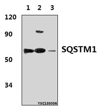 Polyclonal Rabbit anti-Human SQSTM1 Antibody (IHC, WB)