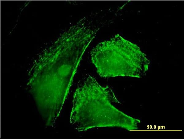 IQGAP1 Antibody (clone 2C5)