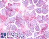 IHC-plus™ Polyclonal Rabbit anti-Human NPY5R Antibody (Cytoplasmic Domain, IHC)