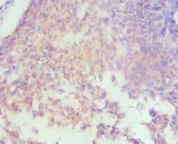 Polyclonal Rabbit anti-Human HAS3 Antibody (aa339-553, IHC)