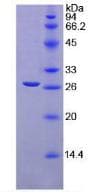 Mouse TGFBI Protein (Recombinant His, N-Terminal)