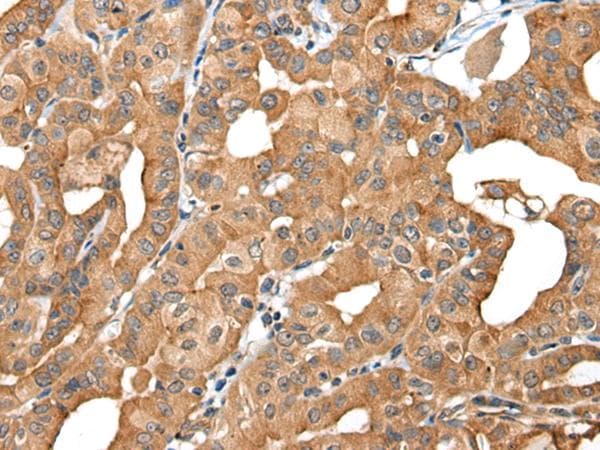 Polyclonal Rabbit anti-Human INF2 Antibody (IHC)