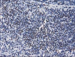 CTDSP1 / SCP1 Antibody (clone OTI1B5)