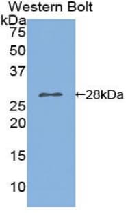 PLA2G6 / IPLA2 Antibody (aa481-702)