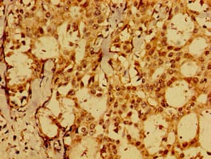 Polyclonal Rabbit anti-Human FAIM Antibody (WB)
