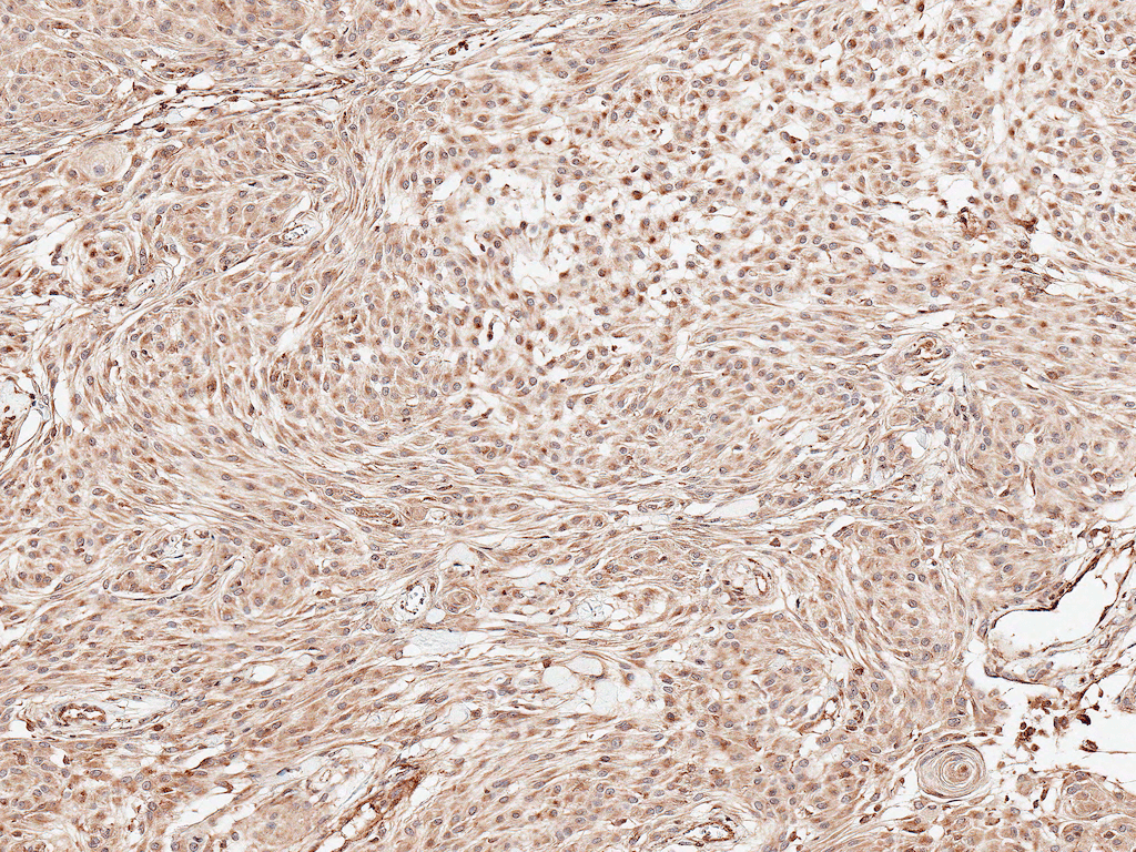 PSEN1 / Presenilin 1 Antibody