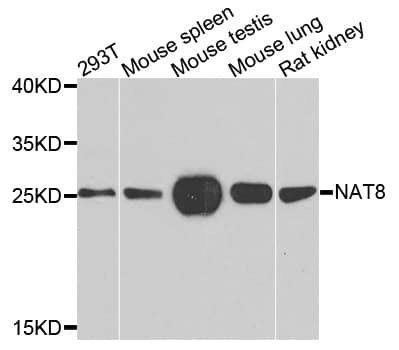 Polyclonal Rabbit anti-Human TSC501 / NAT8 Antibody (IHC, WB)