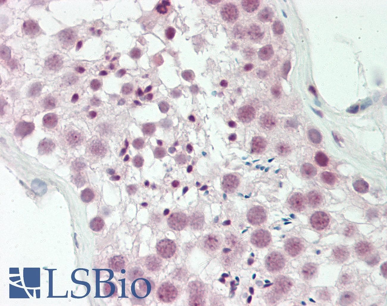 HMG1 / HMGB1 Antibody (N-Terminus)