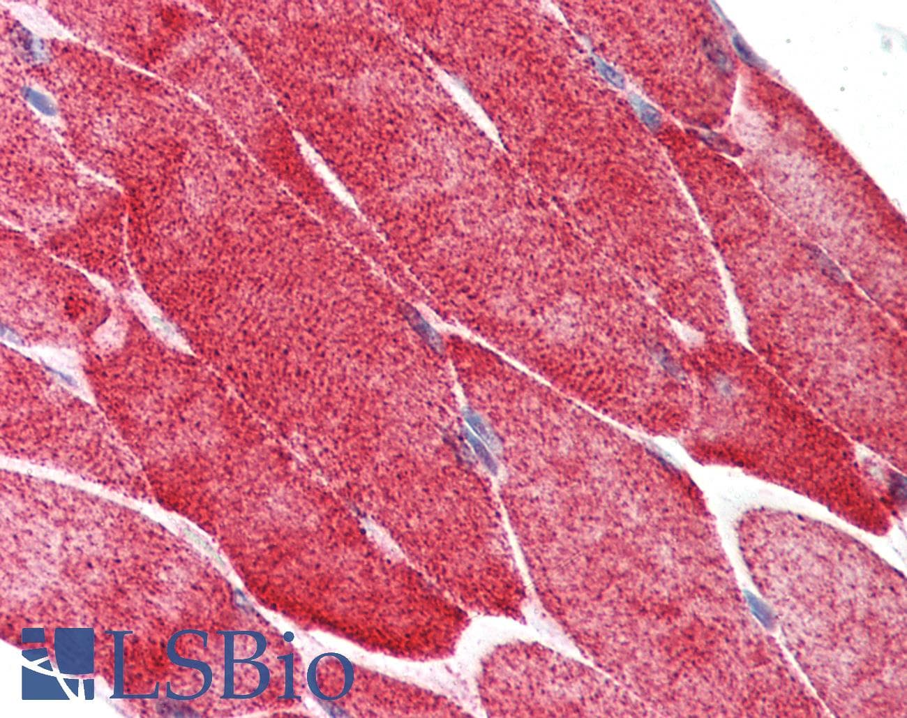 PathPlus™ HSPB1 / HSP27 Antibody (clone G3.1)