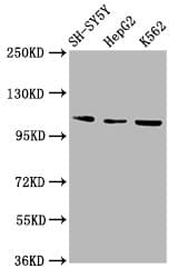 Polyclonal Rabbit anti-Human ULK2 Antibody (IHC, WB)