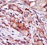 Polyclonal Rabbit anti-Human CIB2 / KIP2 Antibody (aa8-37, IHC, WB)