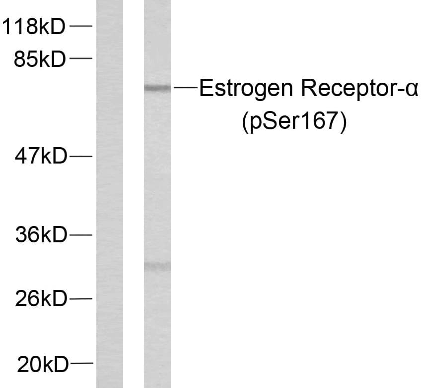 ER Alpha / Estrogen Receptor Antibody (phospho-Ser167)