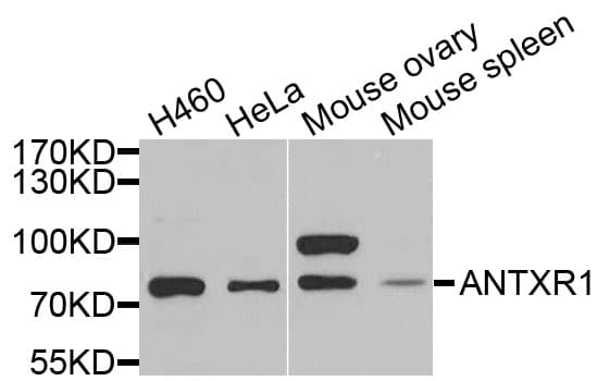 IHC-plus™ Polyclonal Rabbit anti-Human ANTXR1 / TEM8 Antibody (IHC, IF, WB)