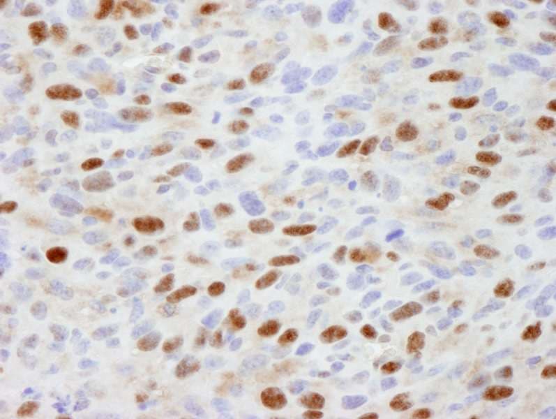 ASH2L / ASH2 Antibody (aa225-275)