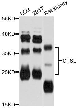 Polyclonal Rabbit anti-Human CTSL / Cathepsin L Antibody (WB)