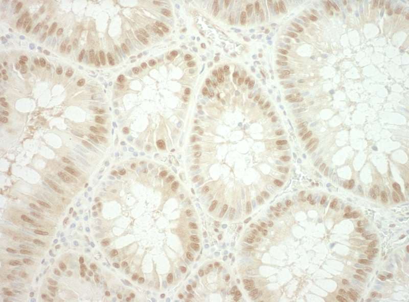 Polyclonal Rabbit anti-Human TIP48 / RUVBL2 Antibody (aa1-50, IHC)