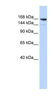 PPL / Periplakin Antibody (aa1044-1093)