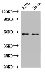 Polyclonal Rabbit anti-Human RPL4 / Ribosomal Protein L4 Antibody (IHC, IF, WB)