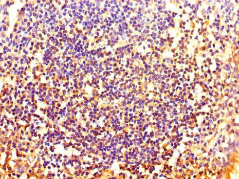 HOXA2 Antibody