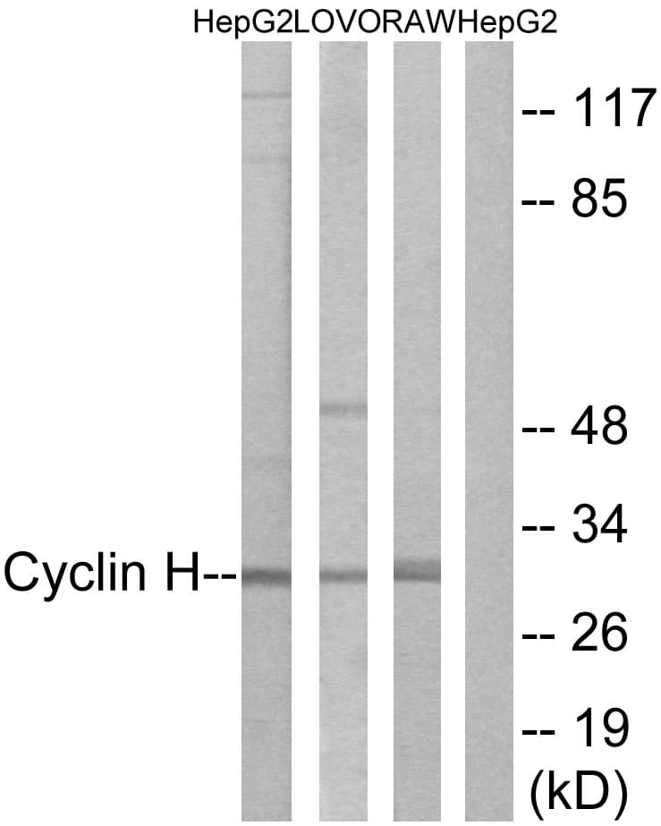 Polyclonal Rabbit anti-Human CCNH / Cyclin H Antibody (aa274-323, IHC, IF, WB)
