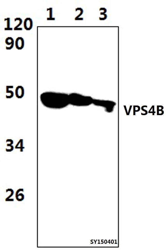 SKD1 / VPS4B Antibody