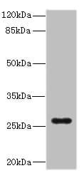 TNFSF15 / TL1A / VEGI Antibody