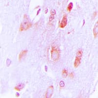 TH / Tyrosine Hydroxylase Antibody (N-Terminus)