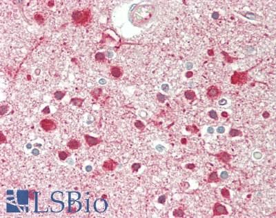 IHC-plus™ ACTN1 Antibody