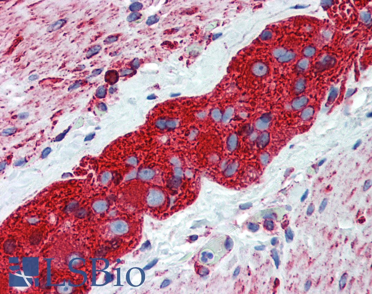 IHC-plus™ Monoclonal Mouse anti-Human TUBB2A / Tubulin Beta 2A Antibody (clone 3F9, IHC, IF, WB)