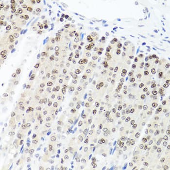 PARP1 Antibody
