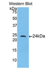 TLR5 Antibody (aa46-205)