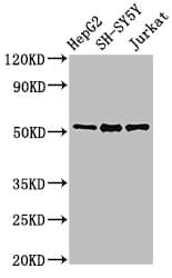 Polyclonal Rabbit anti-Human PARK2 / Parkin 2 Antibody (aa1-465)