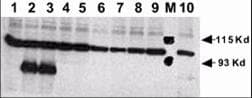 Polyclonal Rabbit anti-Human NOTCH1 Antibody (N-Terminus, IHC, WB)