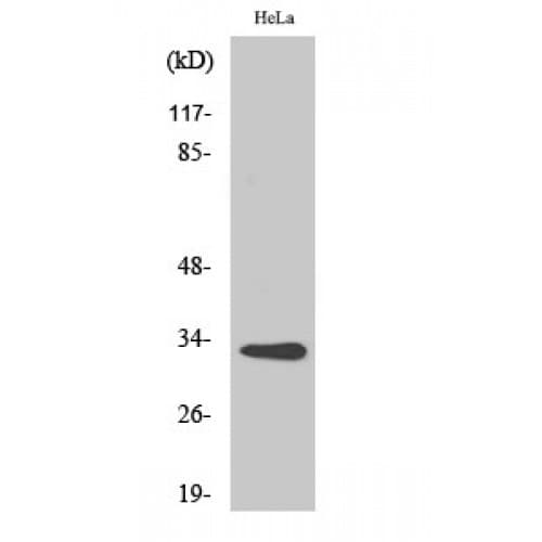 Polyclonal Rabbit anti-Human CNOT7 Antibody (10-90 aa, N-terminal, IHC, WB)