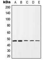 CXCR4 Antibody (phospho-Ser339)