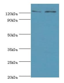 Polyclonal Rabbit anti-Human KDM4B / JMJD2B Antibody (aa1-260, IHC, WB)