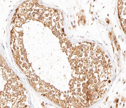 MMP16 Antibody