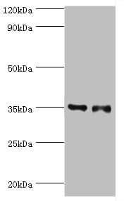 SULT1E1 / Sulfotransferase 1E1 Antibody