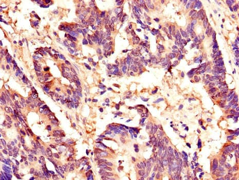 HCF1 / HCFC1 Antibody