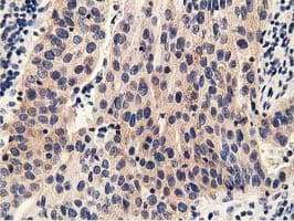 Monoclonal Mouse anti-Human PRKD2 / PKD2 Antibody (clone OTI5A3, IHC, IF, WB)