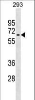 Polyclonal Rabbit anti-Human RNF168 Antibody (aa468-496, WB)