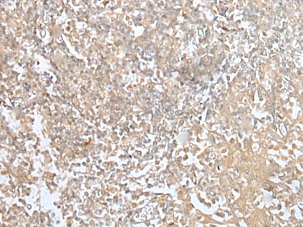 Polyclonal Rabbit anti-Human MORF4L1 / MRG15 Antibody (IHC)