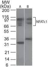 IHC-plus™ Polyclonal Rabbit anti-Human NFATC1 / NFAT2 Antibody (aa263-282, IHC, WB)