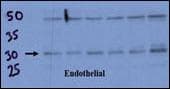 Polyclonal Rabbit anti-Human RCAN1 / DSCR1 Antibody (aa222-252, WB)