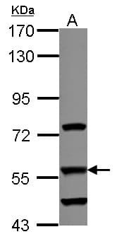 DUS2 / DUS2L Antibody