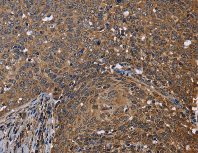 FHIT Antibody