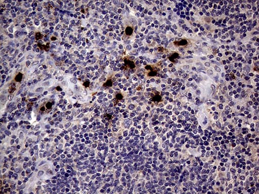 PRTN3 / Myeloblastin Antibody (aa28-248, clone OTI9C2)