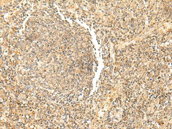 DHFR Antibody