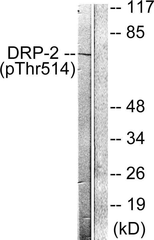 DPYSL2 / CRMP2 Antibody (phospho-Thr514)